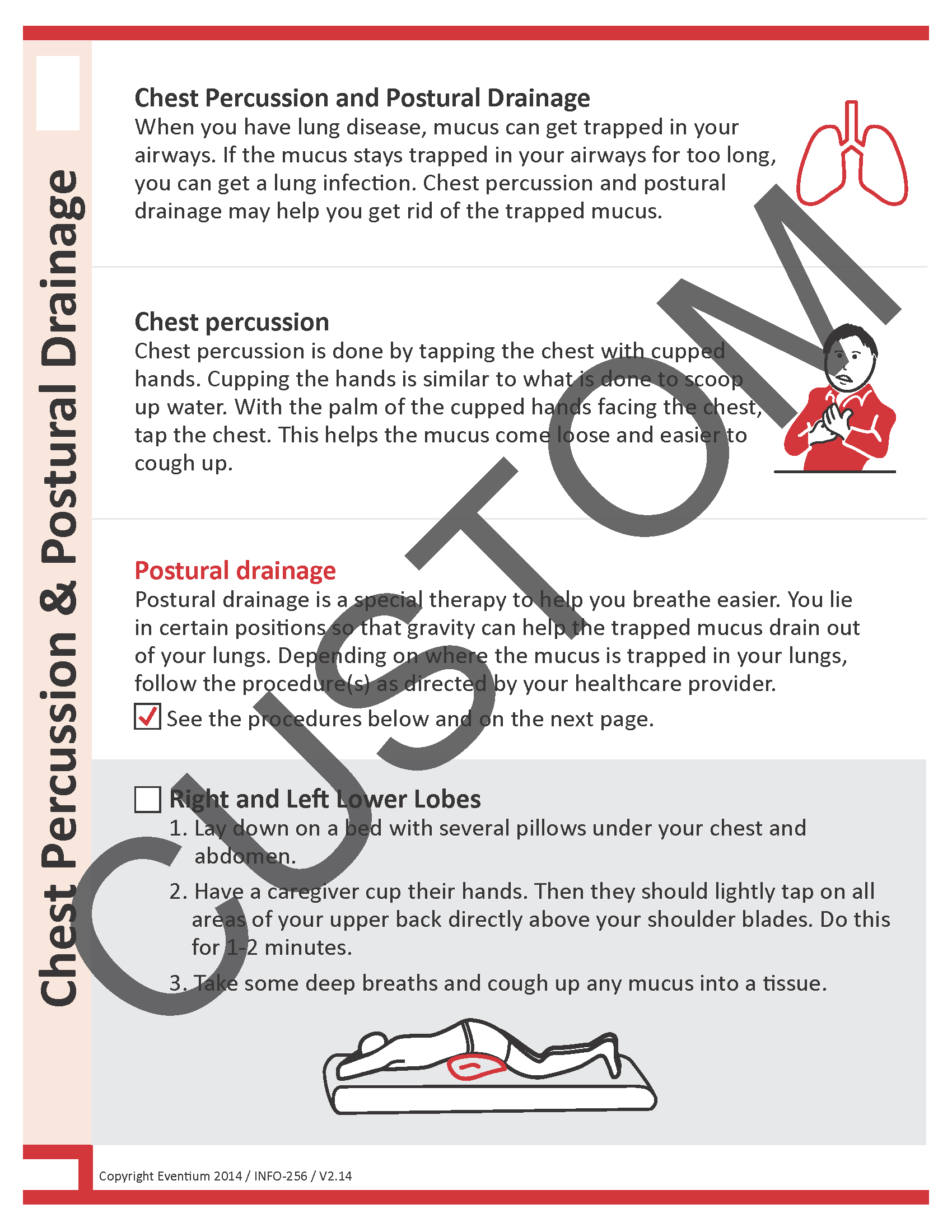 Chest Percussion/Postural Drainage Custom Eventium